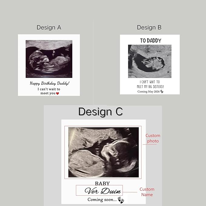 NAZENTI Personalised Ultrasound Building Blocks gifts - Image 5